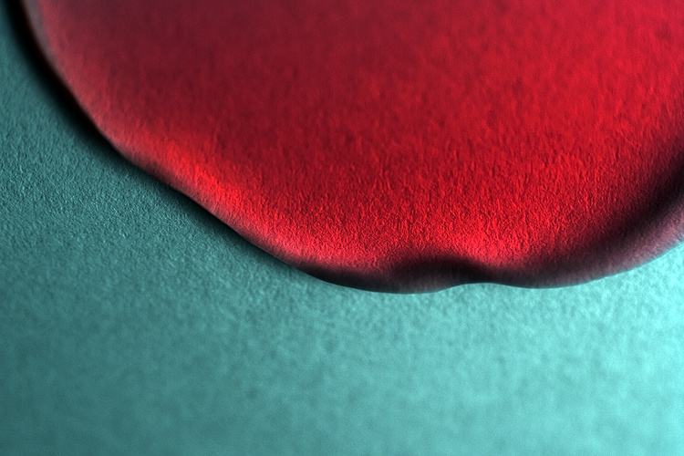 Intimate details